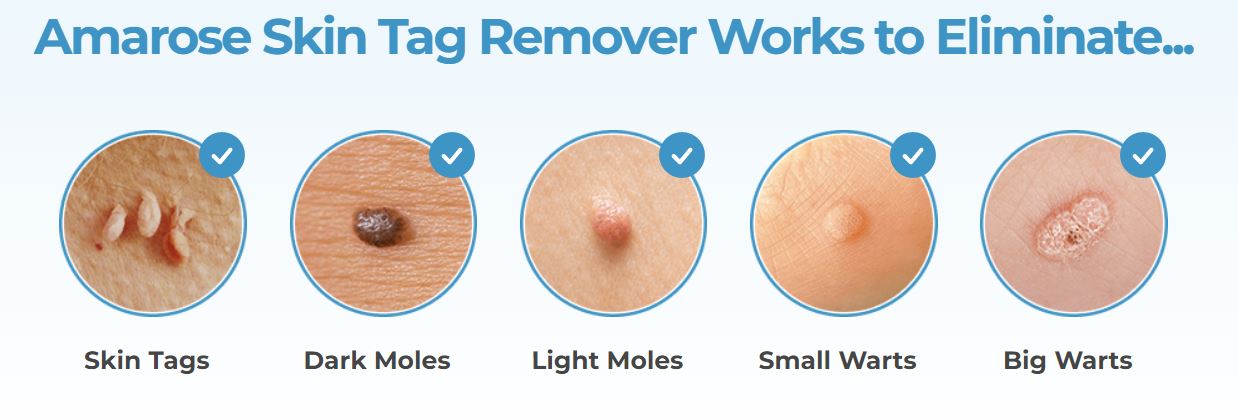 Amarose Skin Tag Remover
